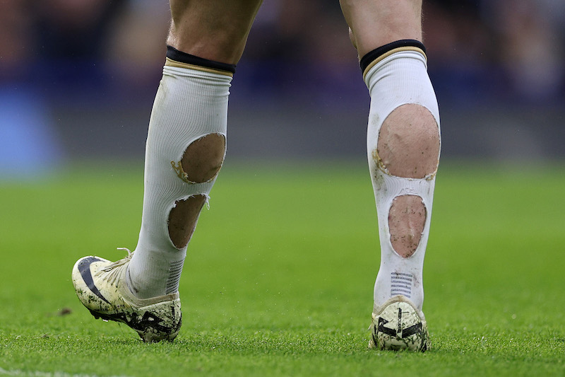 英国の大物司会者が流行する“穴あきソックス”に苦言「くだらないことは